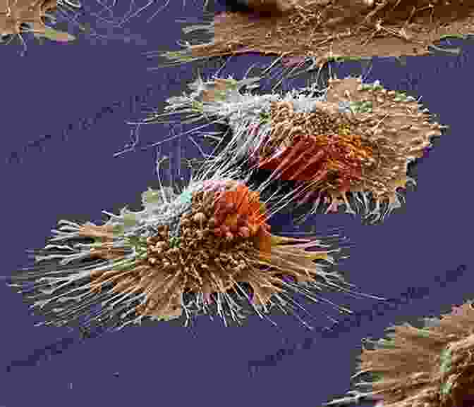 Cancer Cells Under A Microscope The Cancer Chronicles: Unlocking Medicine S Deepest Mystery