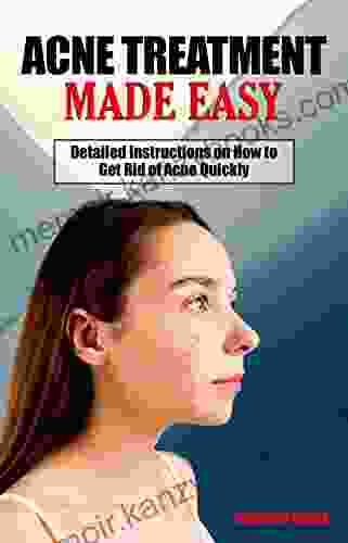 ACNE TREATMENT MADE EASY: Detailed Instructions On How To Get Rid Of Acne Quickly A Simple Step By Step Guide To Treating Acne Address Acne From The Root Causes