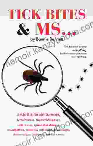 Tick Bites MS